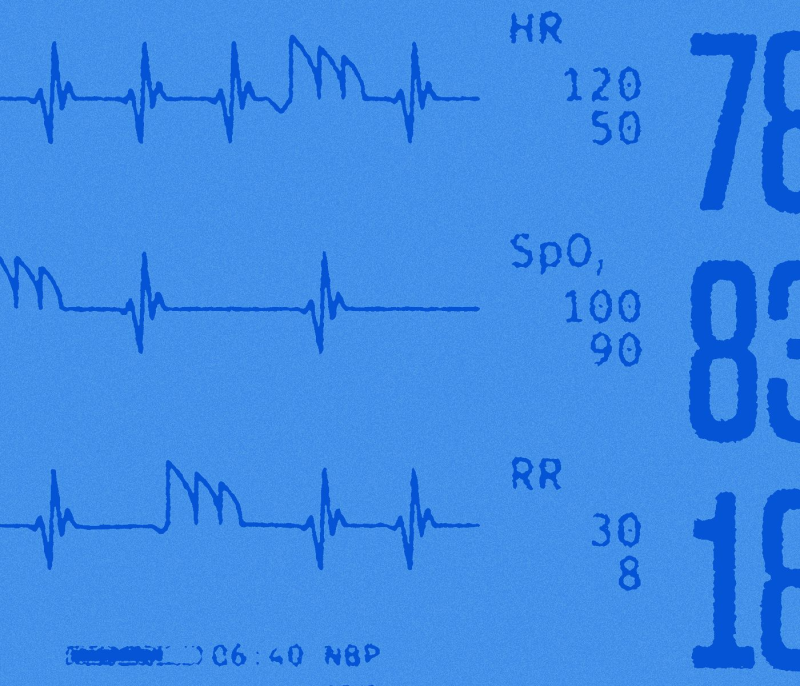 Obrázek epizody Death Interrupted