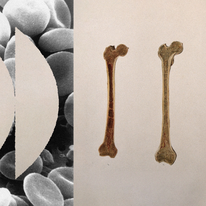 Obrázek epizody Match Made in Marrow