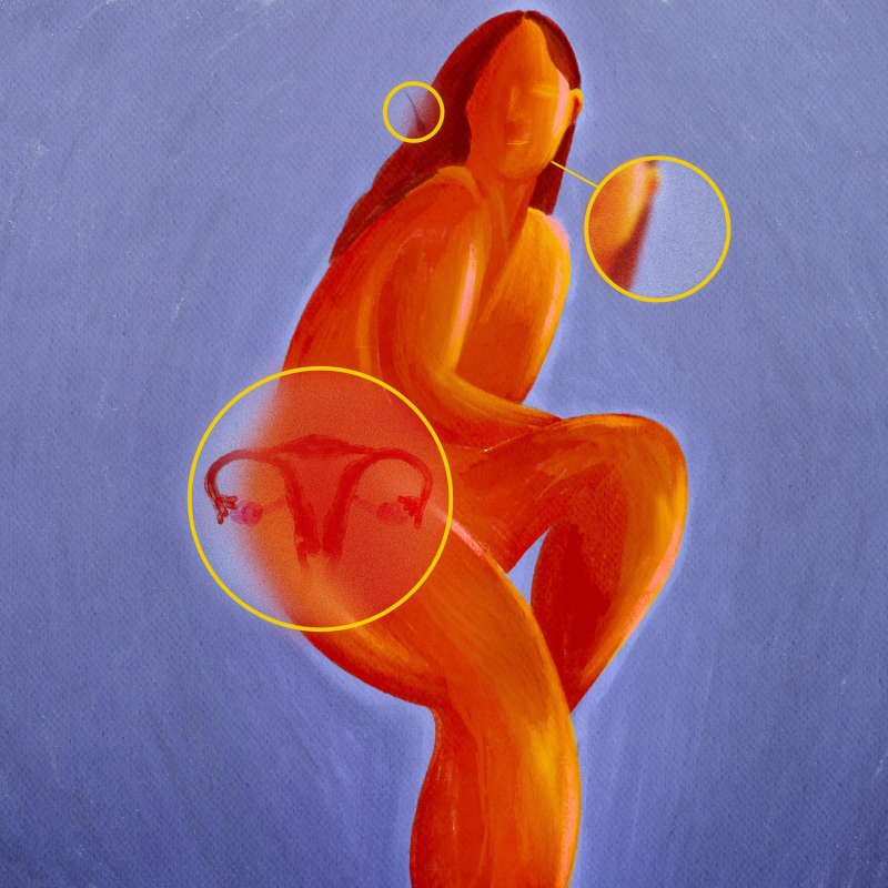 Obrázek epizody Can a name change transform PCOS outcomes for women?