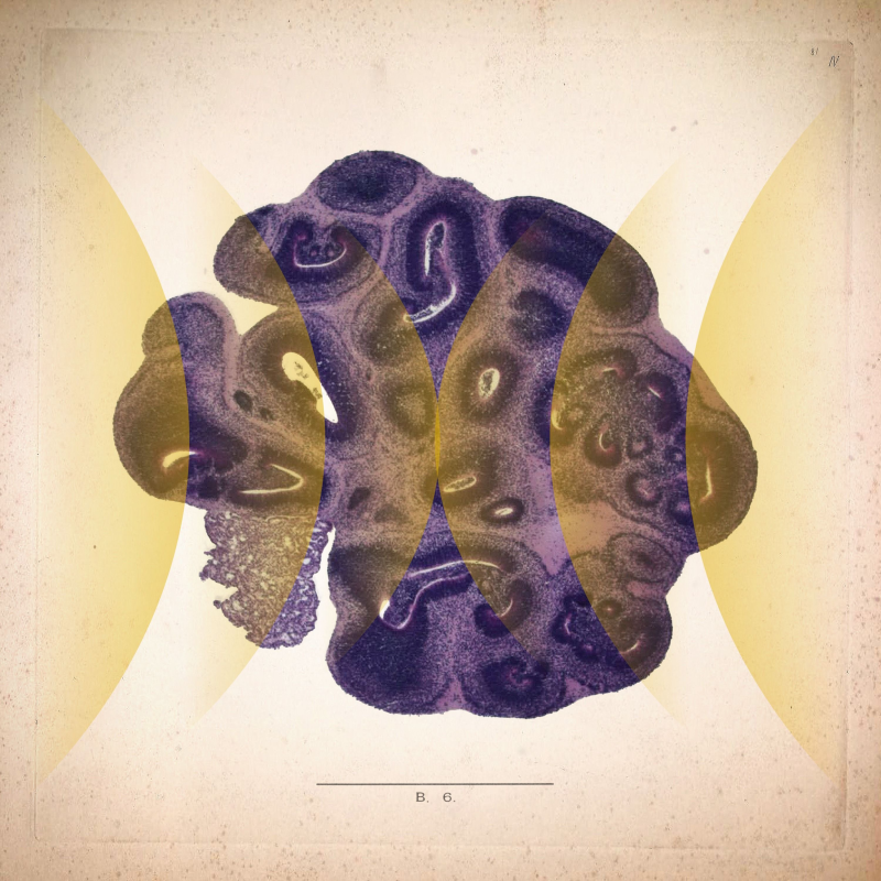 Obrázek epizody Brain Balls