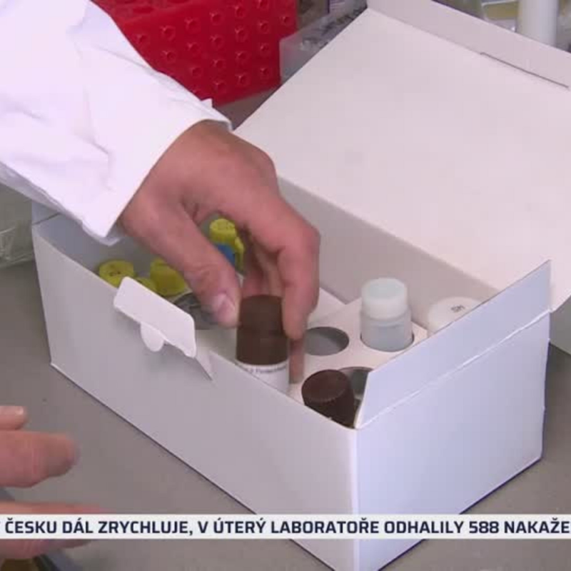 Obrázek epizody Rychlejší test na protilátky (zdroj: CNN Prima NEWS)