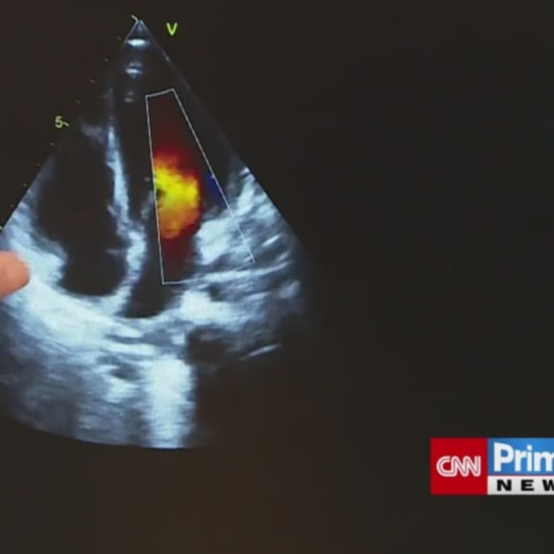 Obrázek epizody Jako když selhávají orgány. Pediatrička popisuje zrádný postcovidový syndrom u dětí