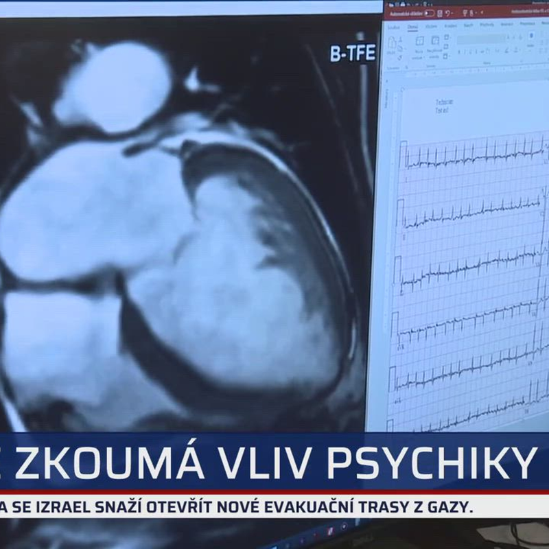 Obrázek epizody Zuperdebata mladých politiků: Bylo to směšné, všichni jsou kopie svých šéfů, míní Kolář