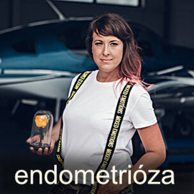 Obrázek epizody #03 ENDOMETRIÓZA s hostkou Mishou Lebedou