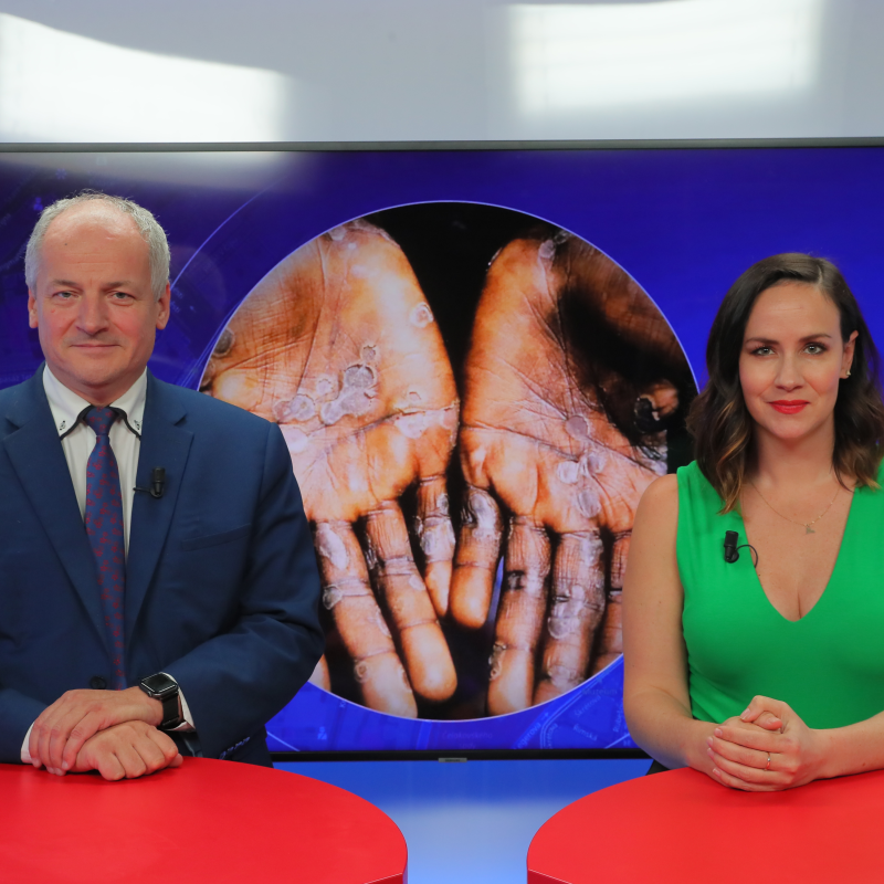Obrázek epizody Epidemiolog Roman Prymula o opičích neštovicích: Šířit se mohou kdekoliv! Najde se hyperšiřitel?