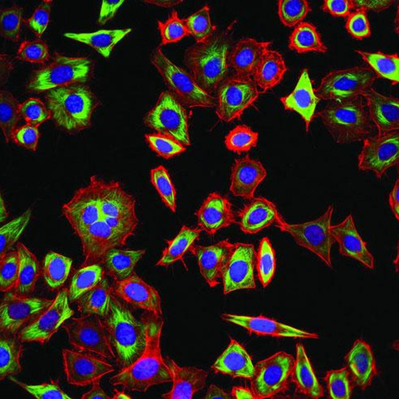 Obrázek epizody Famous Tumors