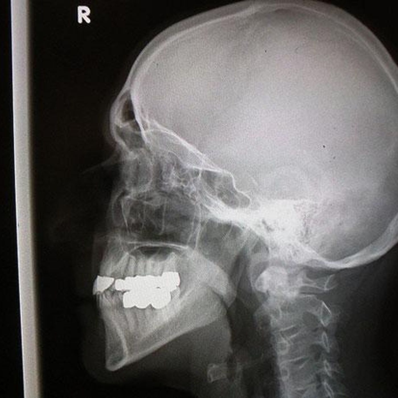 Obrázek epizody Where Am I?