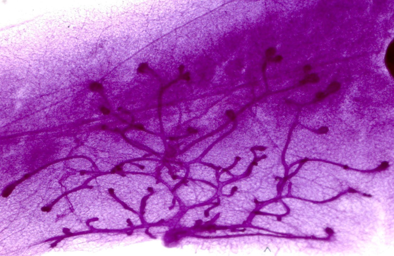Obrázek epizody Co může způsobit agresivní marketing farmaceutického průmyslu?