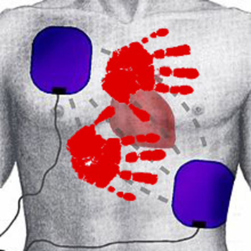 Obrázek epizody (KardioPodcast #10) Defibrilace "HANDS-ON"