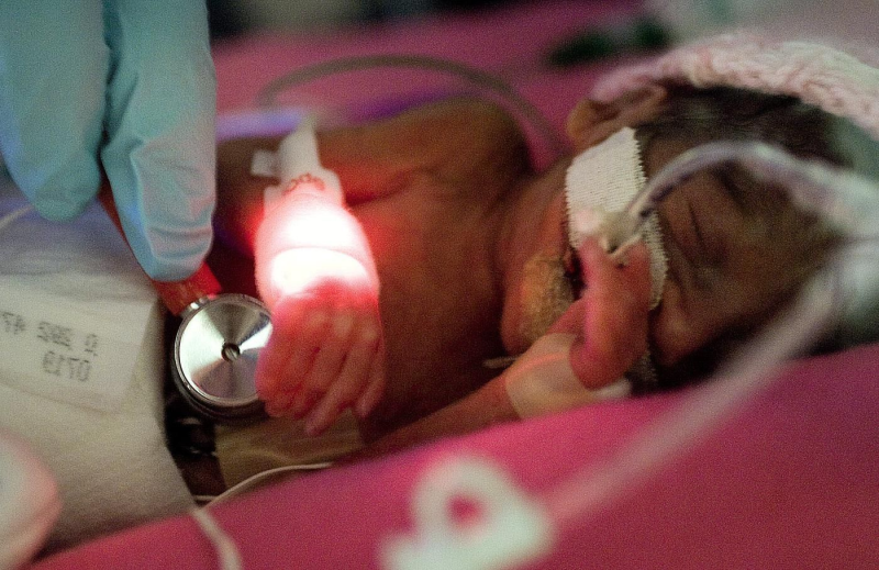 Obrázek epizody Update: 23 Weeks 6 Days