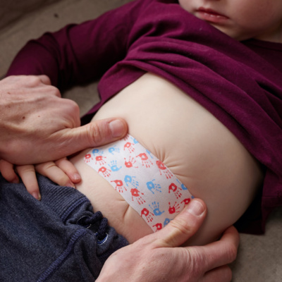 Obrázek epizody Pupeční kýla u dětí: Snadná pomoc, žádný strach