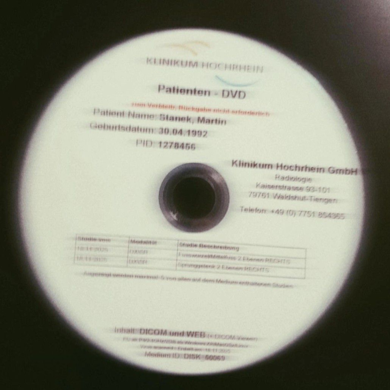 Obrázek epizody Ankle Swollen