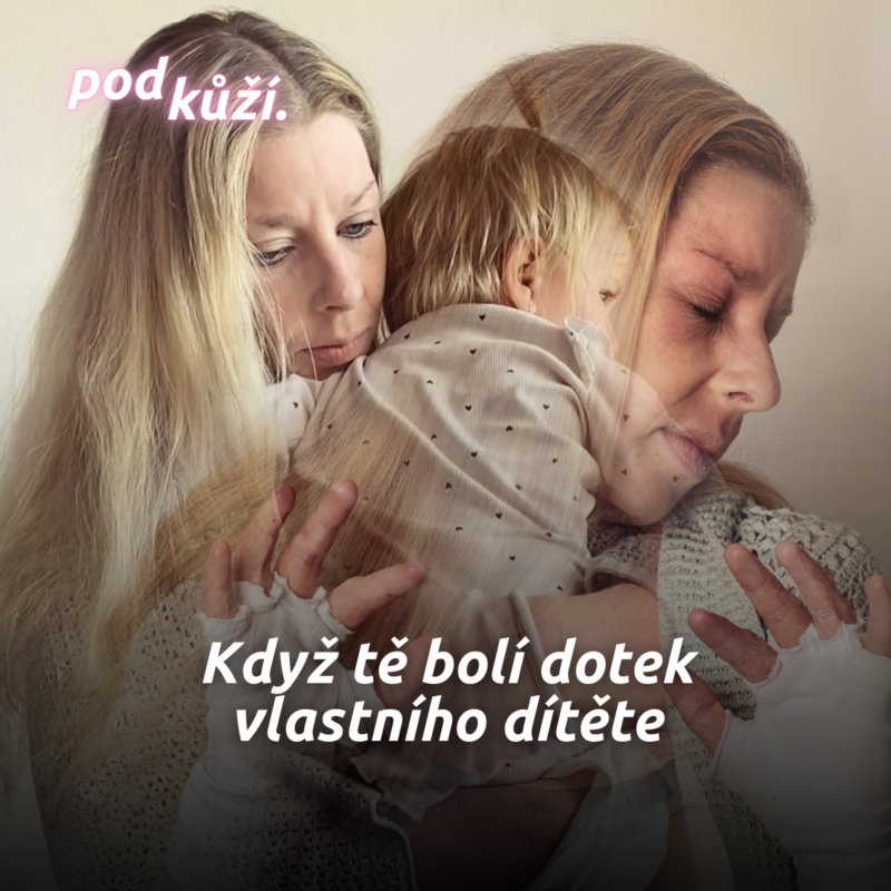 Obrázek epizody Jana: Když jsem měla ekzém, nechtěla jsem se dotknout svého dítěte