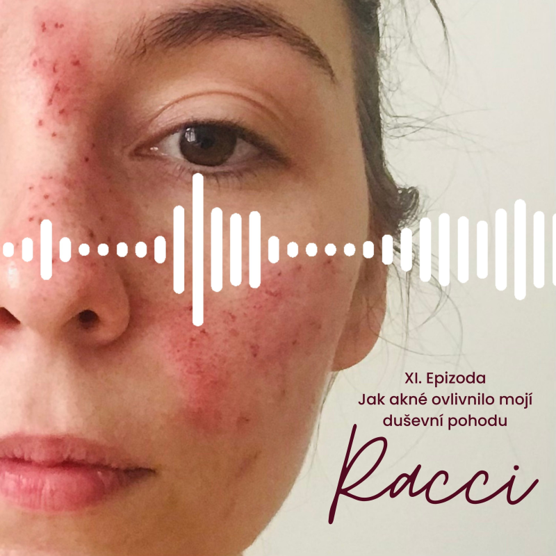 Obrázek epizody Když za akné může kravská bílkovina: 26 let hledání příčiny