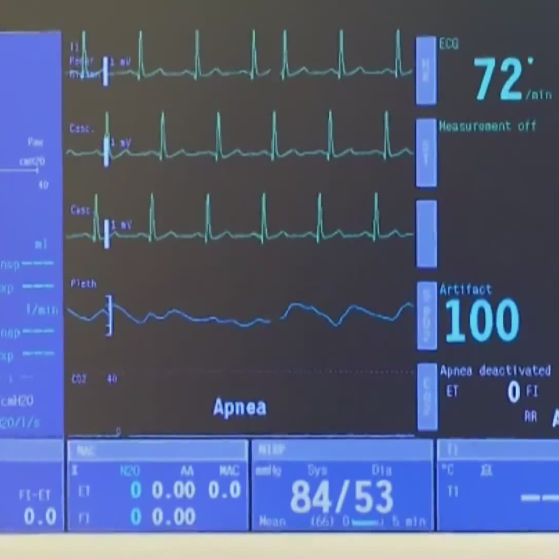 Obrázek epizody Při plastické operaci zemřela pacientka