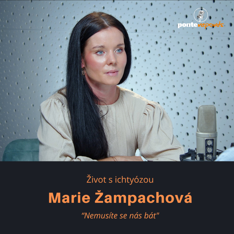 Obrázek epizody Marie Žampachová – život s ichtyózou: Nemusíte se nás bát