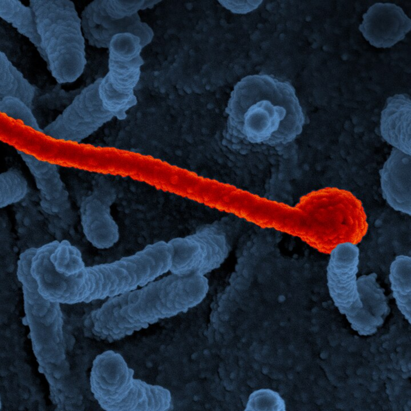 Obrázek epizody Ebola, ptačí chřipka, hantavirus, Marburg... Pomůže AI předejít příští pandemii nebo ji způsobí?