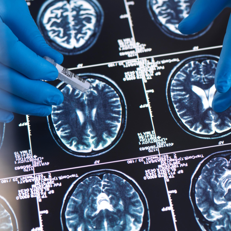 Obrázek epizody The brain’s 5 eras, the vaccine that protects against dementia, altruistic ants