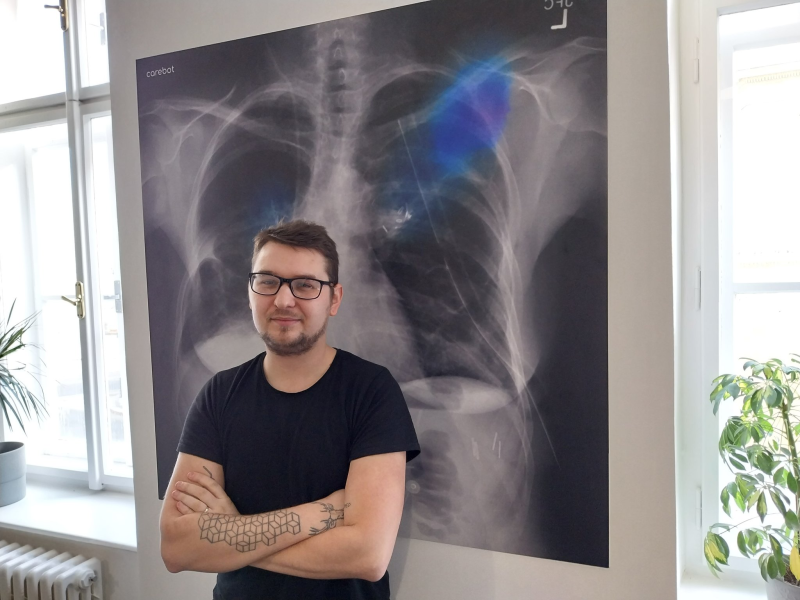 Obrázek epizody Lékaře nenahradí, ale může jim asistovat. Umělá inteligence z Česka čte rentgeny hrudníku