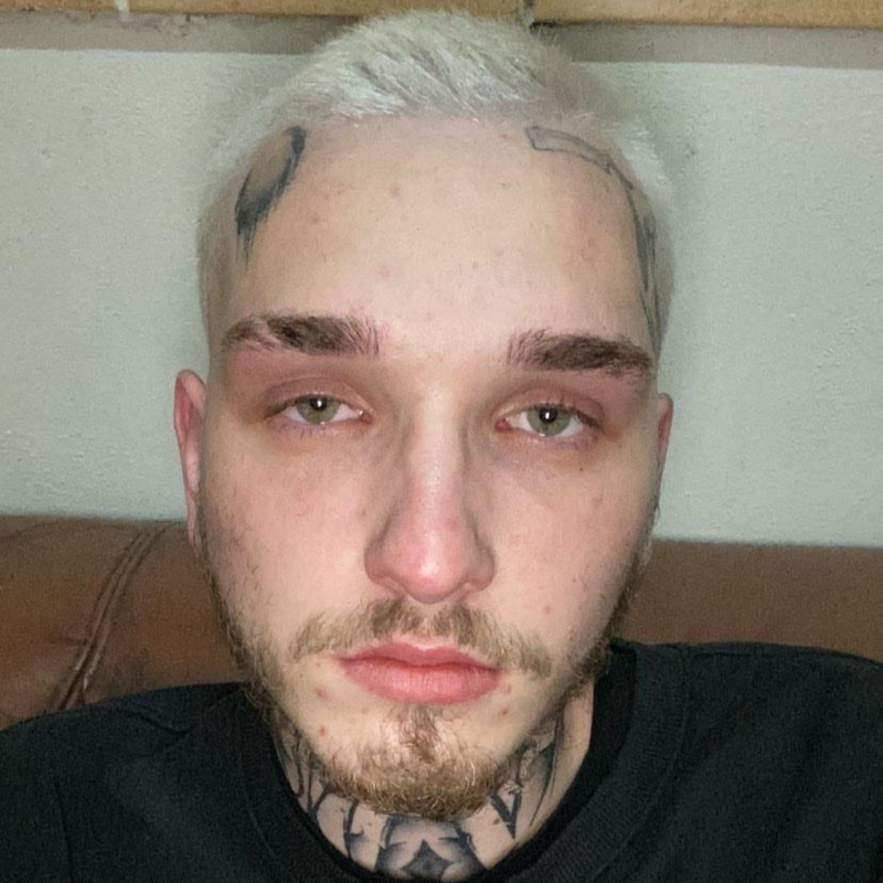 Obrázek epizody Giovanni - Jaké je to žít s bipolární poruchou osobnosti