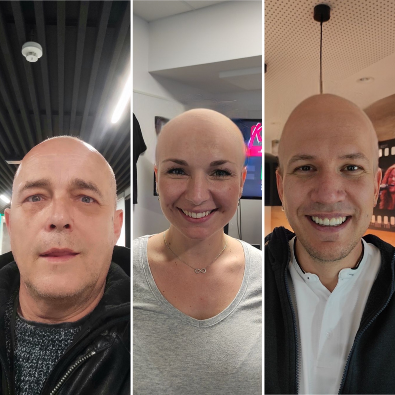 Obrázek epizody RANNÍ KISS - Mezinárodní den plešatých