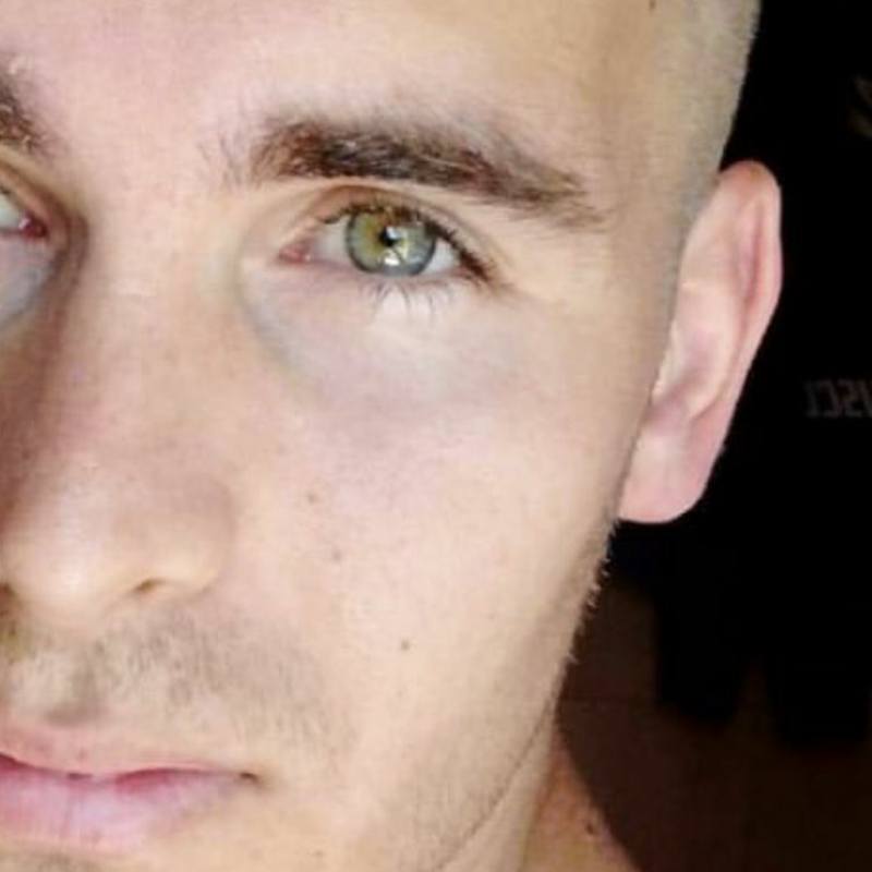 Obrázek epizody EP.75 Honza Kavalir - Viem kedy a ako mám umrieť. Boj s ALS.