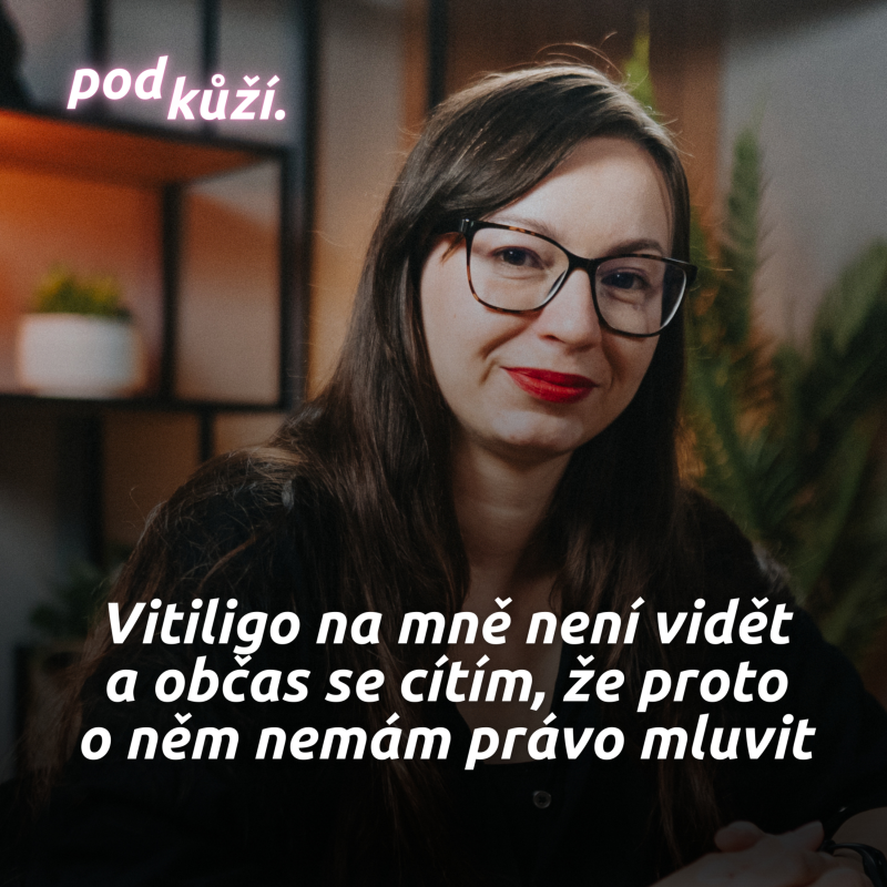 Obrázek epizody Monika z Vitiligo klub: "Nedokonalost" na tobě musí být pořádně vidět, jinak lidi nezajímáš