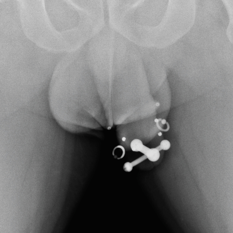 Obrázek epizody Intimní mužské ozdoby: Piercing a beading penisu - Míla Bugtcher ■ Epizoda 20 ■ GAY GUYS PODCAST
