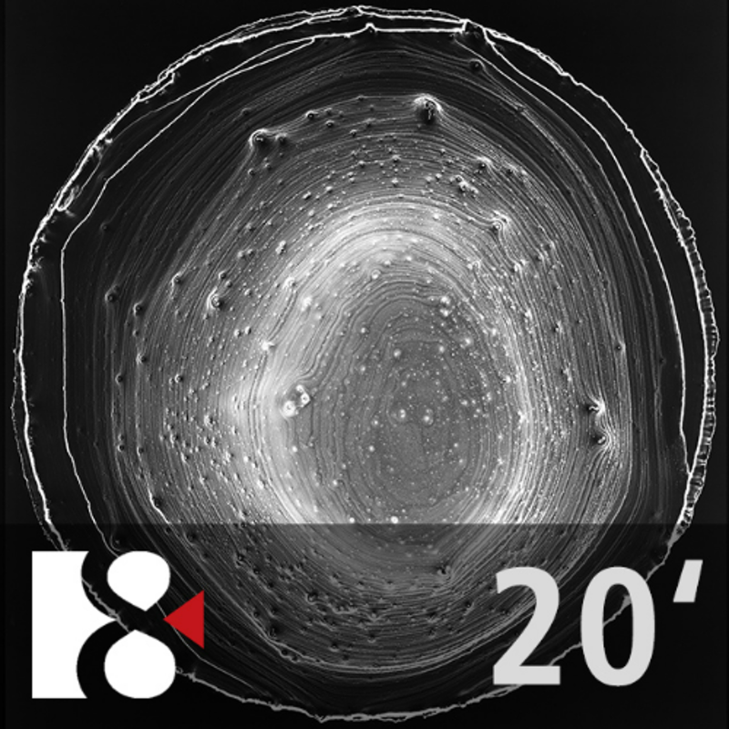 Obrázek epizody Křehkost a zranitelnost | Ve 20 minutách