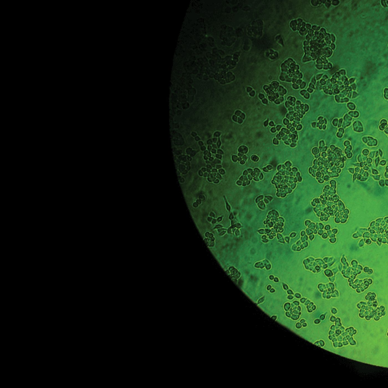 Obrázek epizody Radiolab Extra: Henrietta Lacks