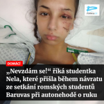 Obrázek epizody Čteme Romea.cz: „Nevzdám se!“ říká studentka Nela, které přišla během návratu ze setkání romských studentů Baruvas při autonehodě o ruku