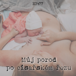 Obrázek epizody EP77: Můj porod po císařském řezu