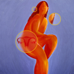 Obrázek epizody Can a name change transform PCOS outcomes for women?