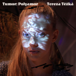 Obrázek epizody #1 Tumor: Polyamor_Tereza Těžká