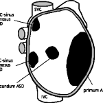 Obrázek epizody (KardioPodcast #4) Státnice z pediatrie jsou tu - aneb Defekt Septa Síní