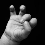 Obrázek epizody Fetal Consequences