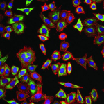 Obrázek epizody Famous Tumors